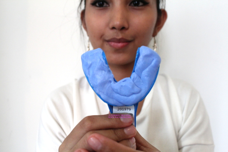 smile brilliant, #tauyanmreviews, malaysia blogger, filipino blogger, 