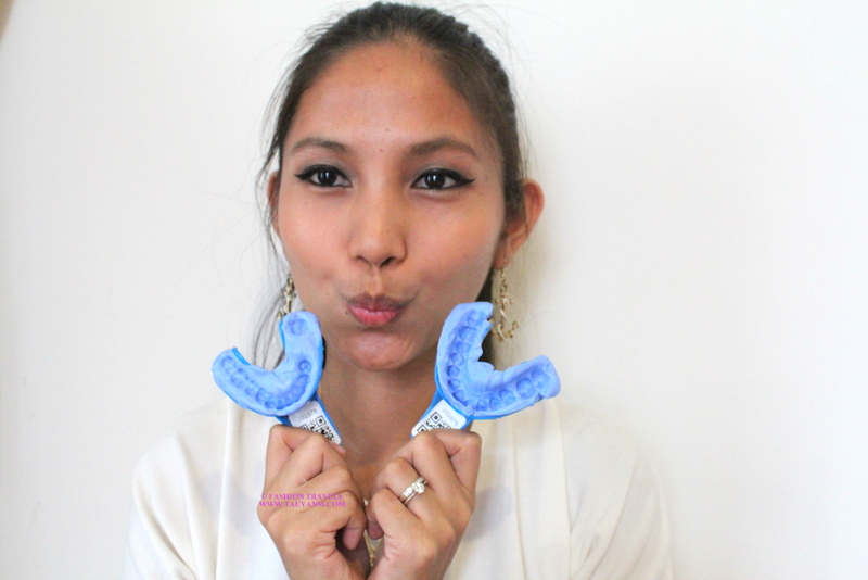 smile brilliant, #tauyanmreviews, malaysia blogger, filipino blogger,