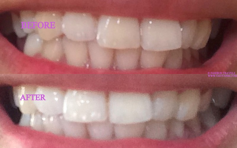 smile brilliant review, malaysia blogger, product review, malaysia beauty blogger, malaysia lifestyle blogger,