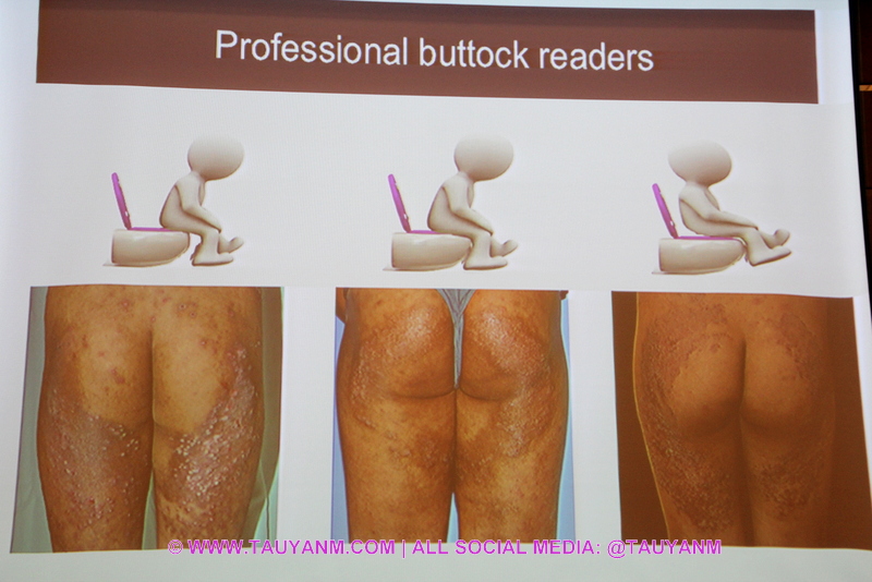 Avène Atopic Eczema