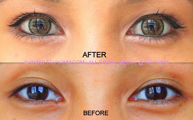 lofa lens review