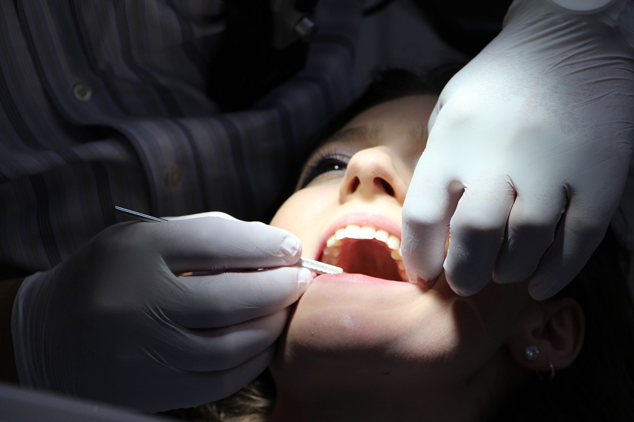 wisdom tooth removal, dentist in dubai, dubai blogger, wisdom tooth removal in dubai