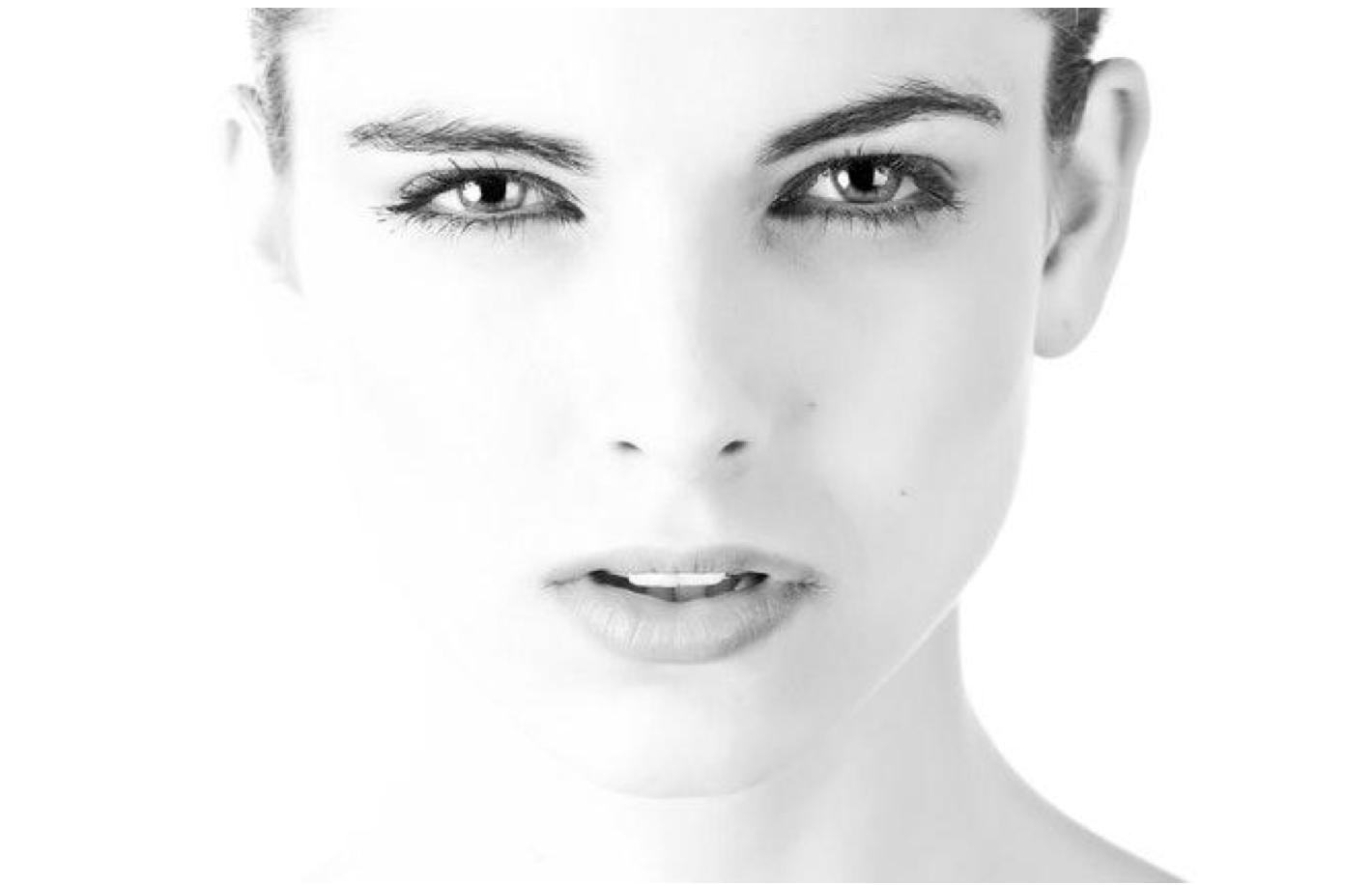 Laser Resurfacing, photofacial, dubai blogger, health blogger, facial, filipino blogger