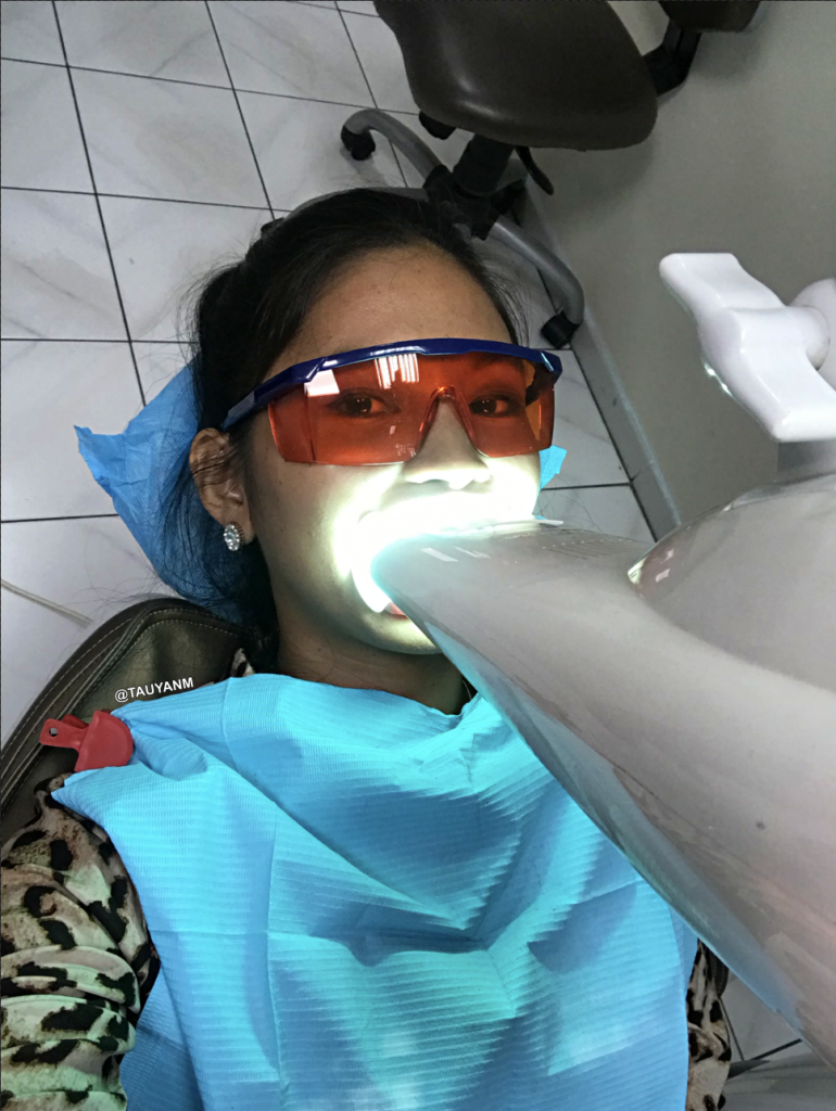 NATIONAL MEDICAL CENTER DUBAI, DUBAI TEETH WHITENING, DUBAI BLOGGER, DUBAI VLOG, teeth whitening, tauyanm, jane fashion travels,